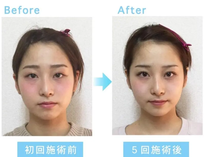 Lov. it ﾗｳﾞｨｯﾄの掲載