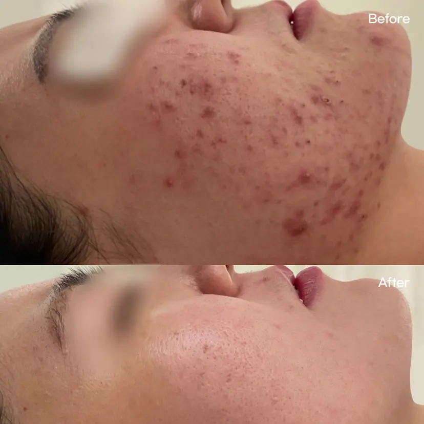 ノ ウンソルの掲載