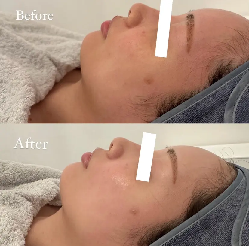 髙山 美優の掲載