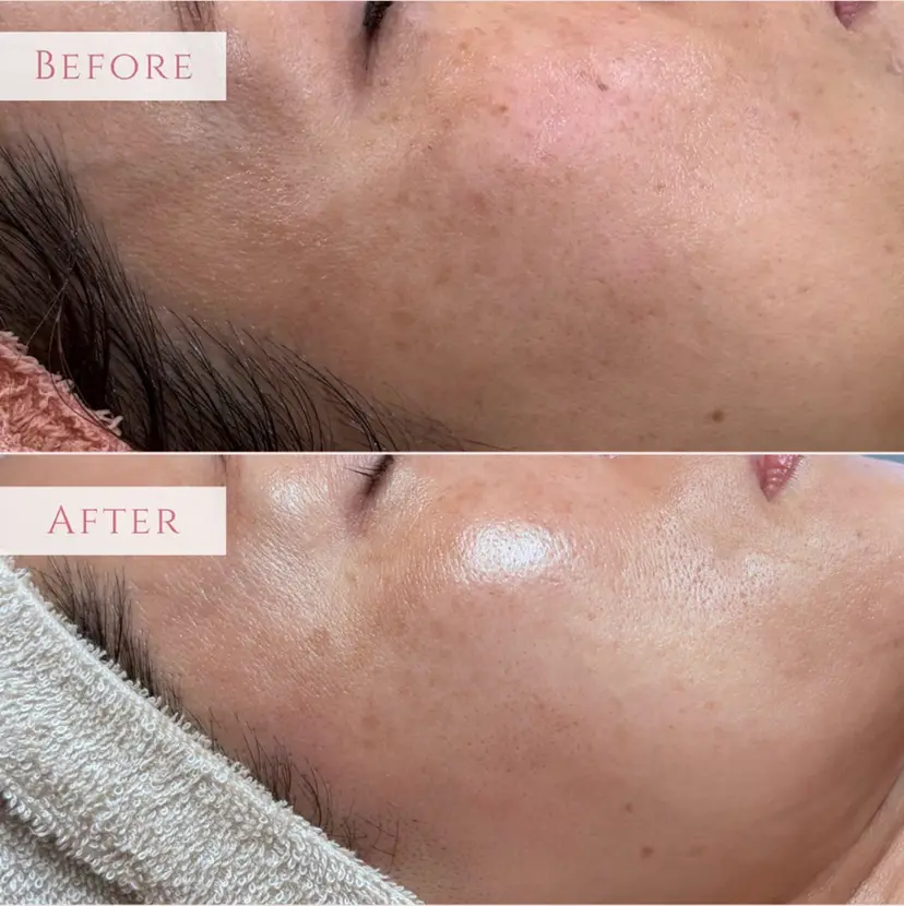 肌育フェイシャル🌿 noel🌿SAKIの掲載