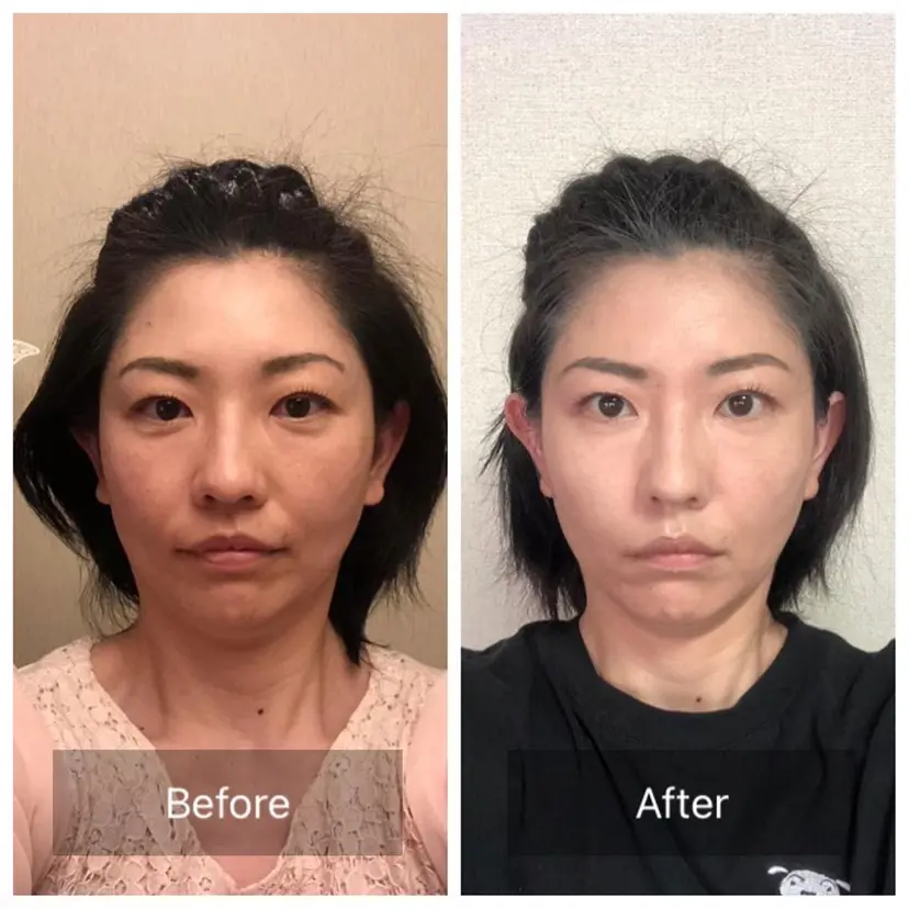 小顔矯正　まつ毛 Komaci篠田敦子の掲載