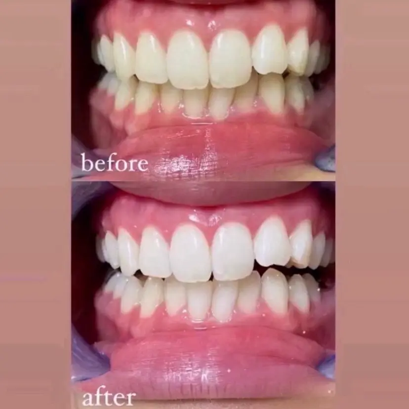 棟久 香澄の掲載