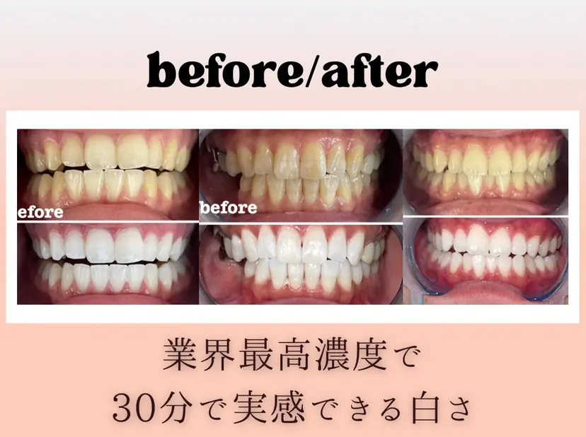 ホワイトニング/脱毛 サロン 麗 御徒町の掲載