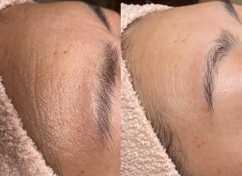 肌悩み専門店 BLOOMi.の掲載