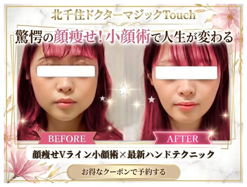 【歴13年】劇的小顔 D rマジックタッチの掲載