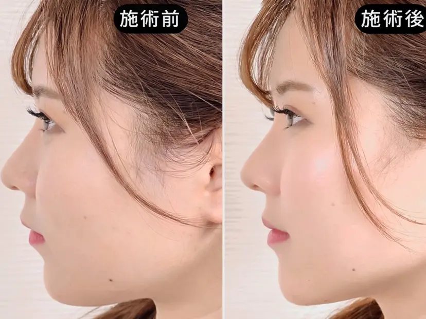 渋谷 小顔美容鍼 専門サロン YZの掲載