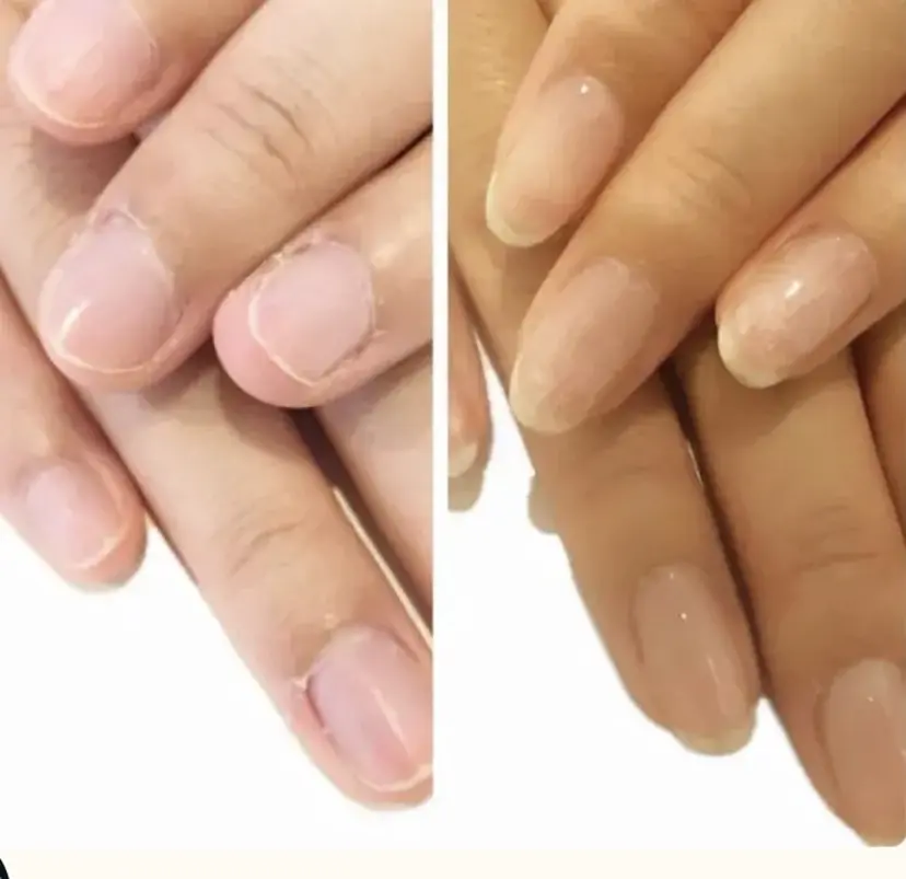 深爪矯正専門サロン ルソアの掲載