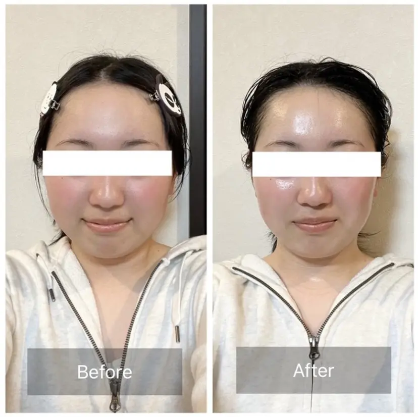 営業電話❌小顔サロン Komorebiの掲載