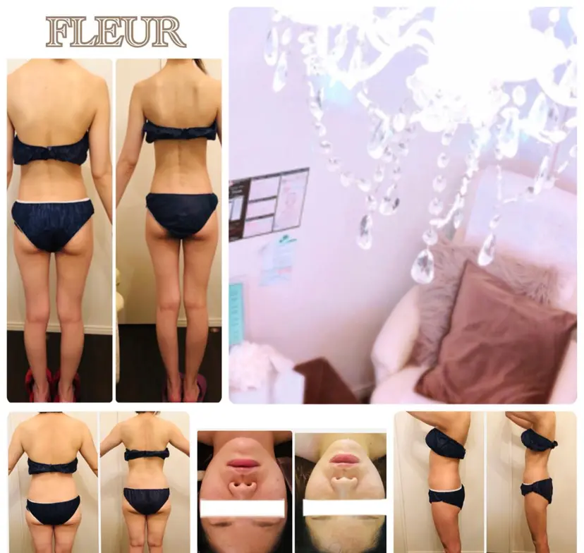FLEUR大阪・美容 整体・痩身・小顔の掲載