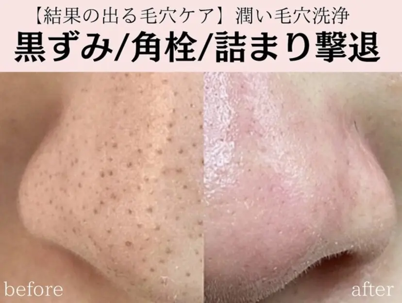 レイエステティック 江南店の掲載