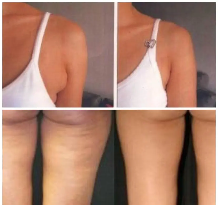 美痩身＆美肌サロン 💐栗原みなの掲載