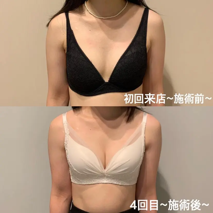 バストアップ専門店 Ti Amoの掲載