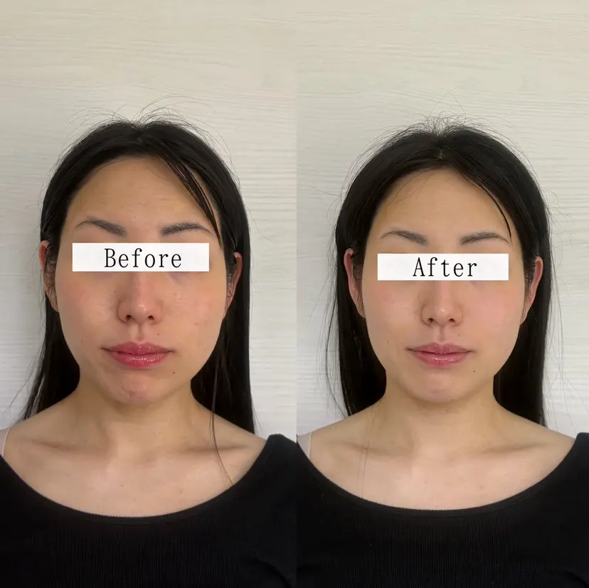 Stellum 小顔矯正&ヘッドスパの掲載