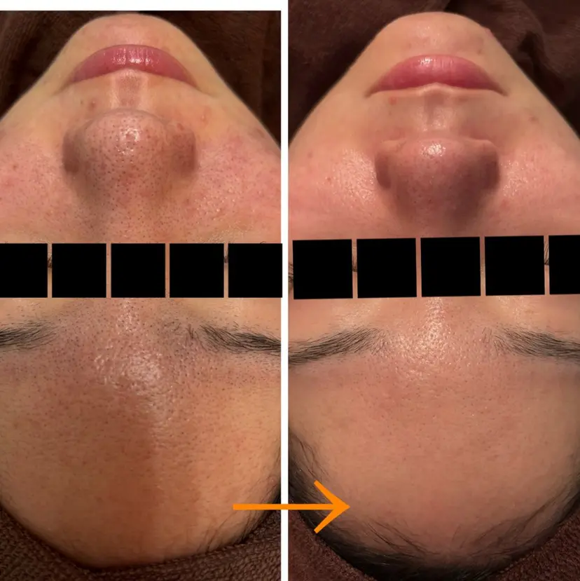 【Resetlab】 Chihiroの掲載