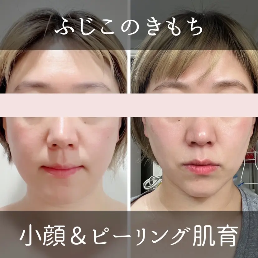 小顔＆ピーリング肌育 ふじこのきもちの掲載