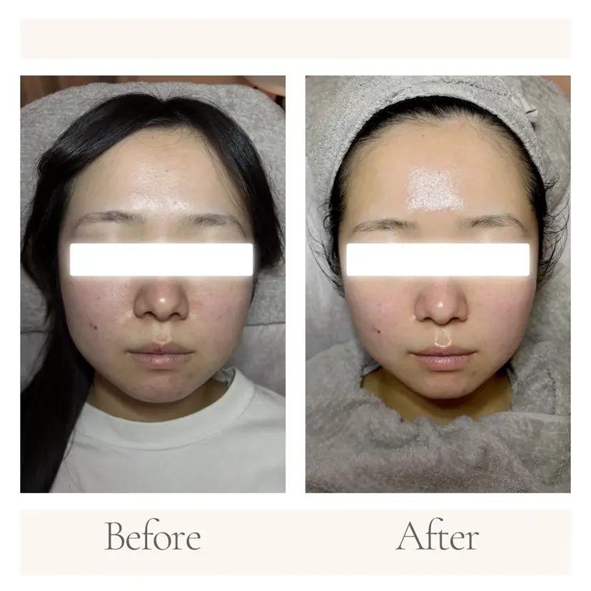 11/1〜Open！ 旭川ナリス脱毛エステの掲載