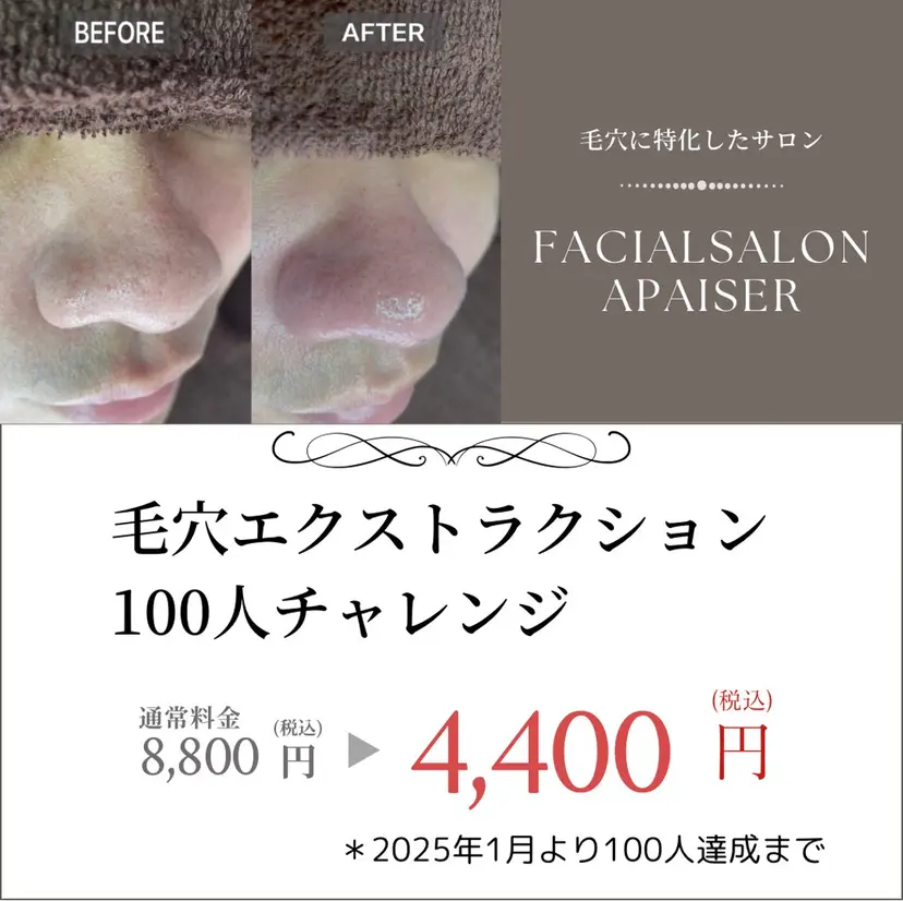 エイジングケアサロン Apaiserの掲載