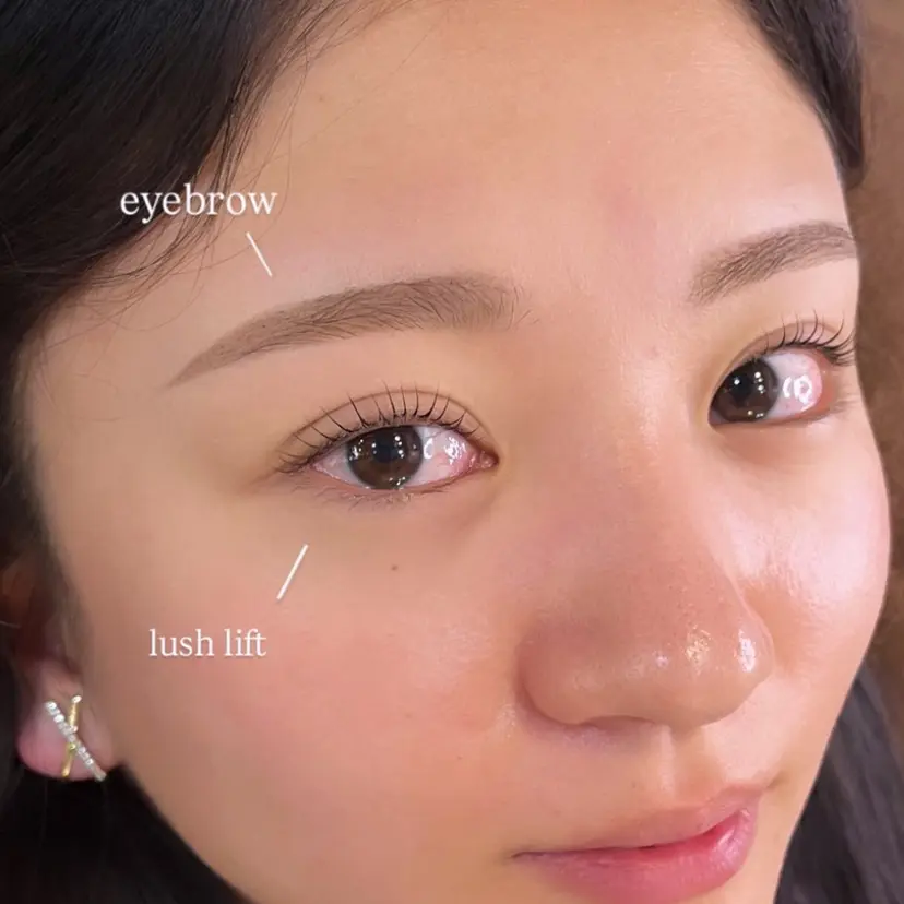 AI🌙 骨格分析の掲載