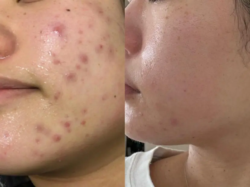 素肌美づくりサロン 《鴻巣・熊谷》の掲載