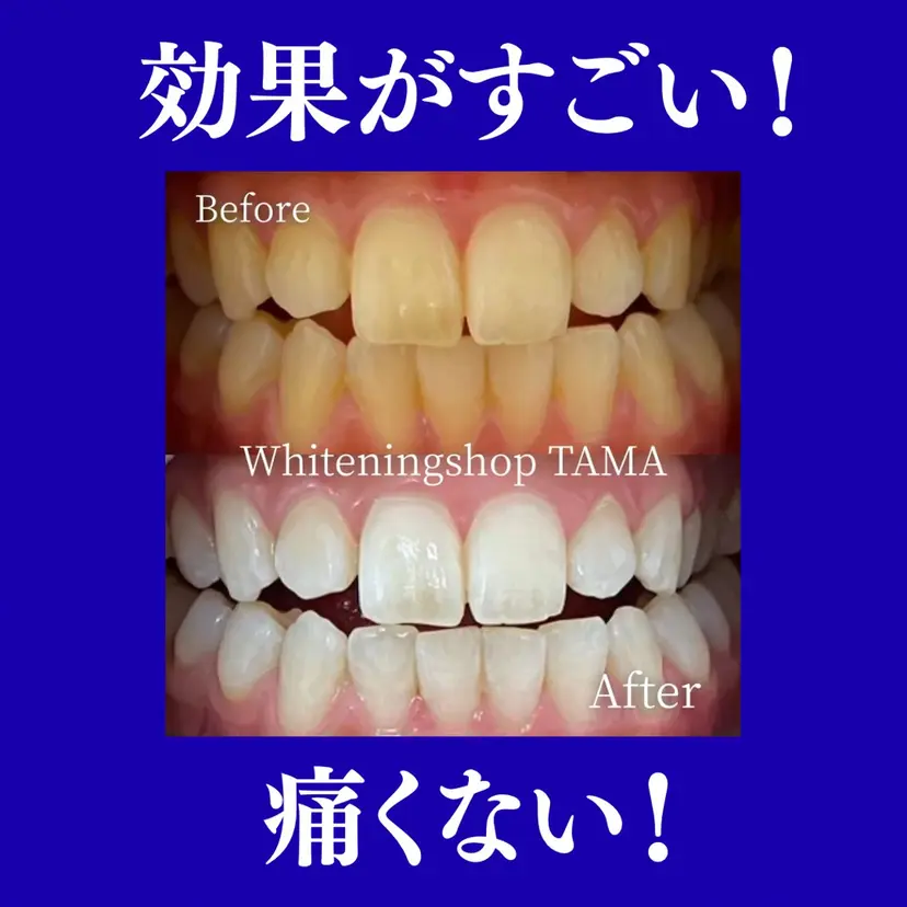 ホワイトニング ショップ多摩店の掲載