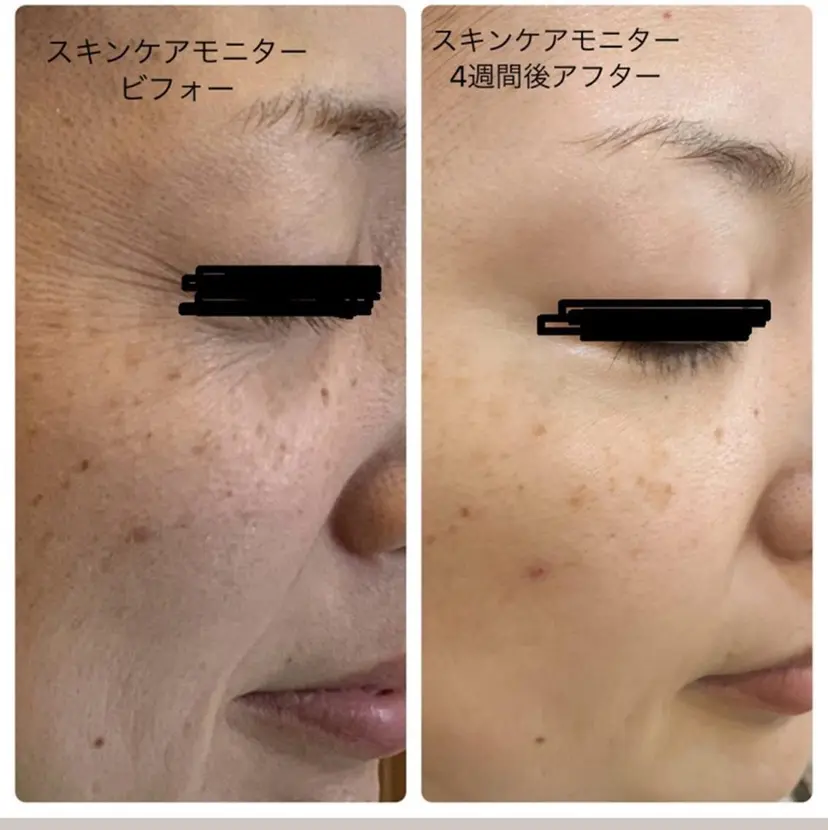 💆‍♀️松田 亜沙美の掲載