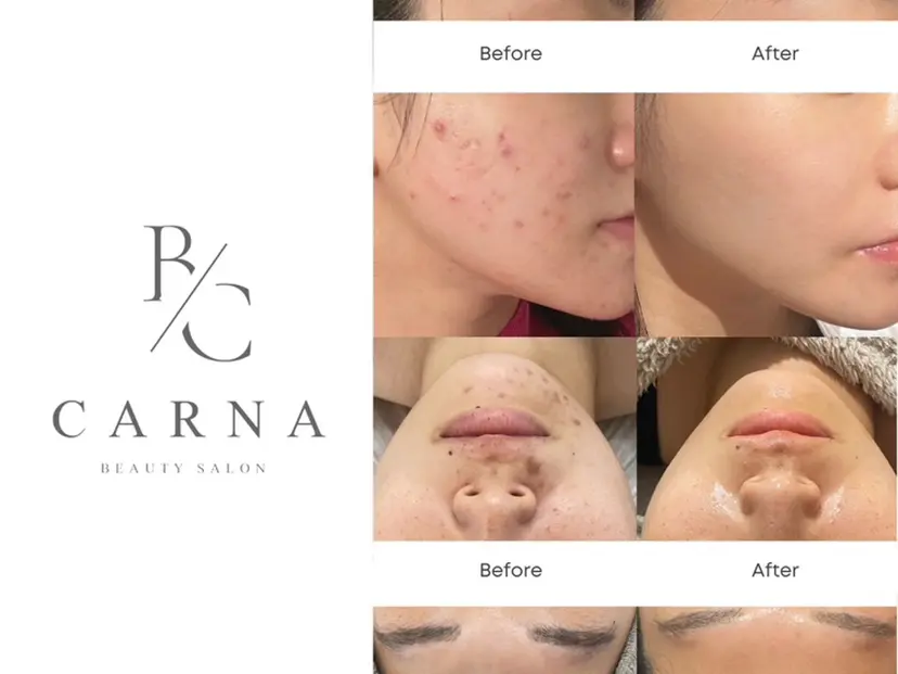 【肌質改善専門店】 CARNAの掲載