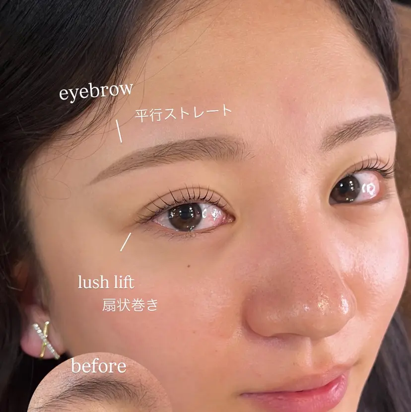 AI🌙 骨格分析の掲載