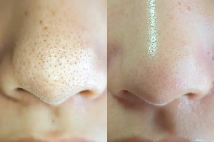  毛穴洗浄・まつ毛 の専門店 ソラーレの掲載