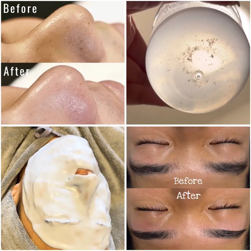 Anuenue 眉毛専用、毛穴洗浄の掲載