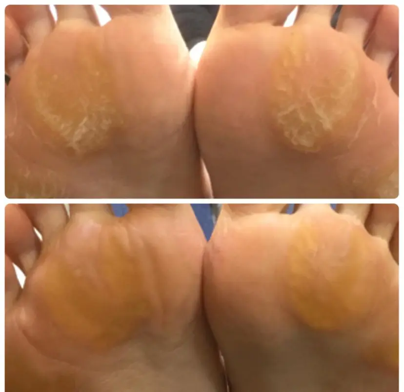 &nudgenail 本多の掲載