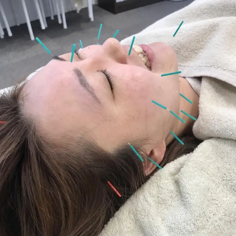 ヒロスポーツ 鍼灸整骨院の掲載