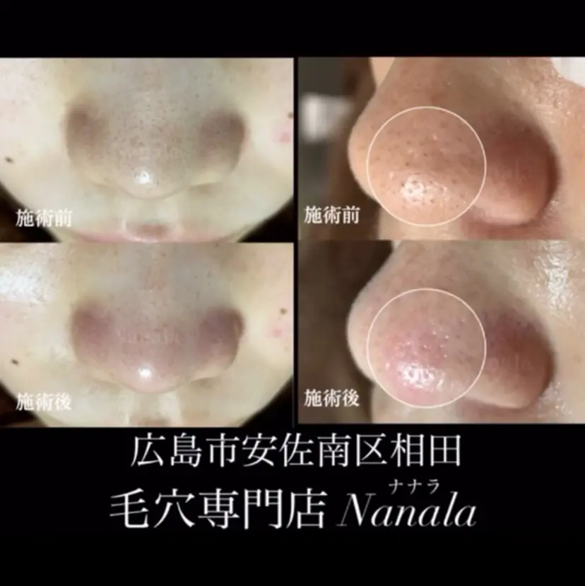 小西 亜惟の掲載