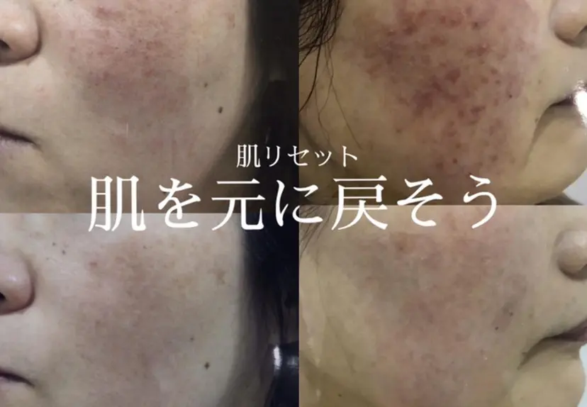 松尾 奈々の掲載