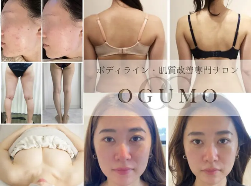 肌管理 OGUMOの掲載