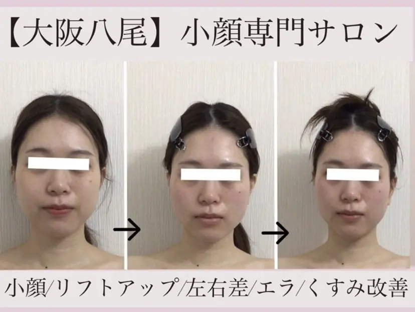 リフトアップ小顔 専門の掲載