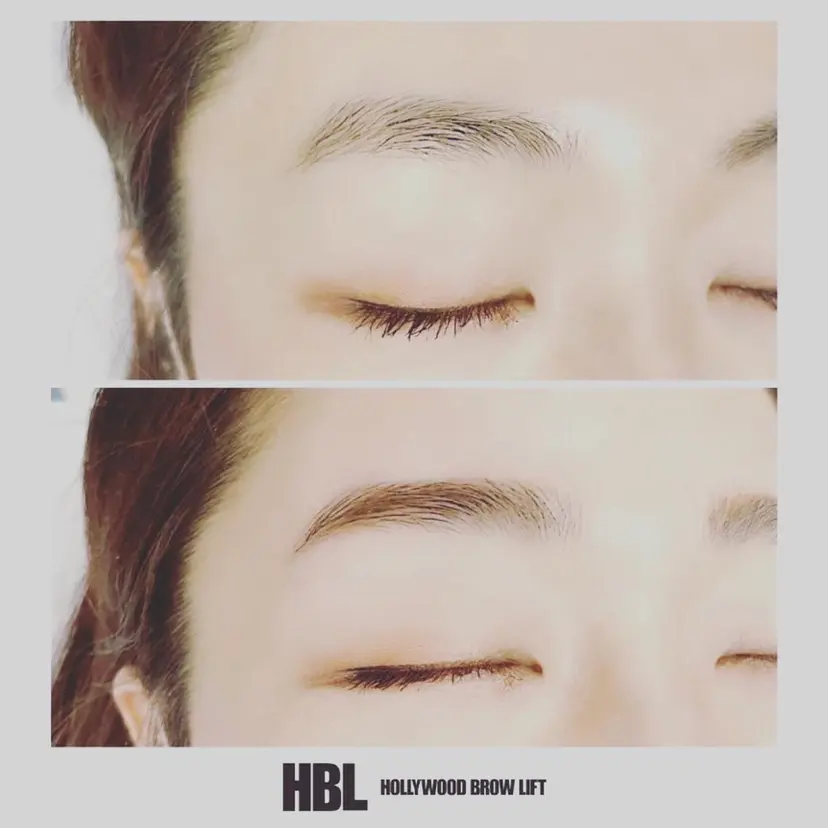 mist Shinobuの掲載