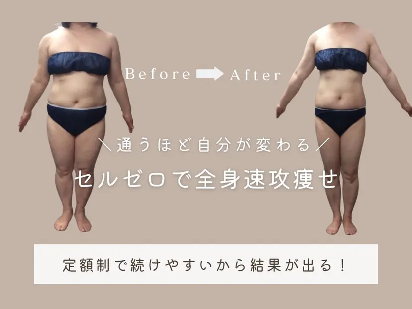 月額制痩身エステ エスプライザの掲載