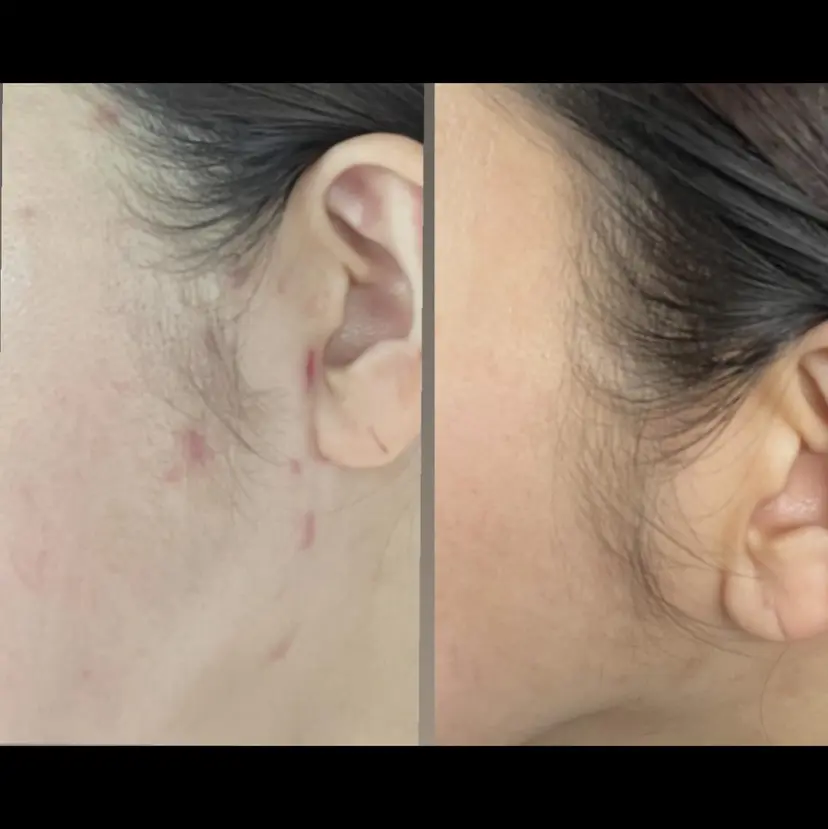 肌荒れ/疲れケア シェソワの掲載