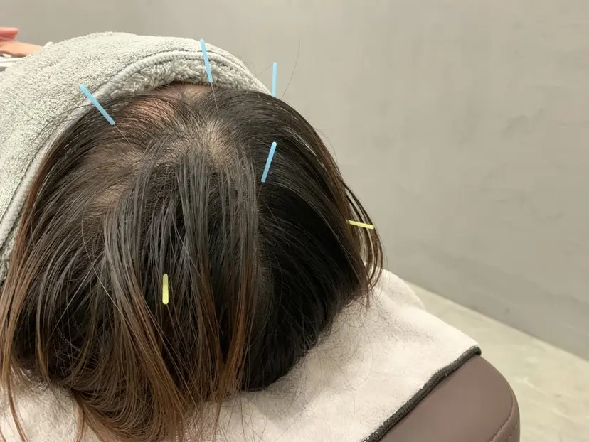 NUR(ヌール) HARI SPOTの掲載