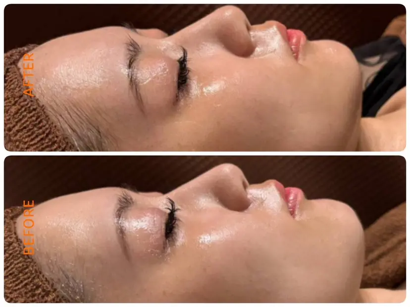 Toshi エステティシャンの掲載