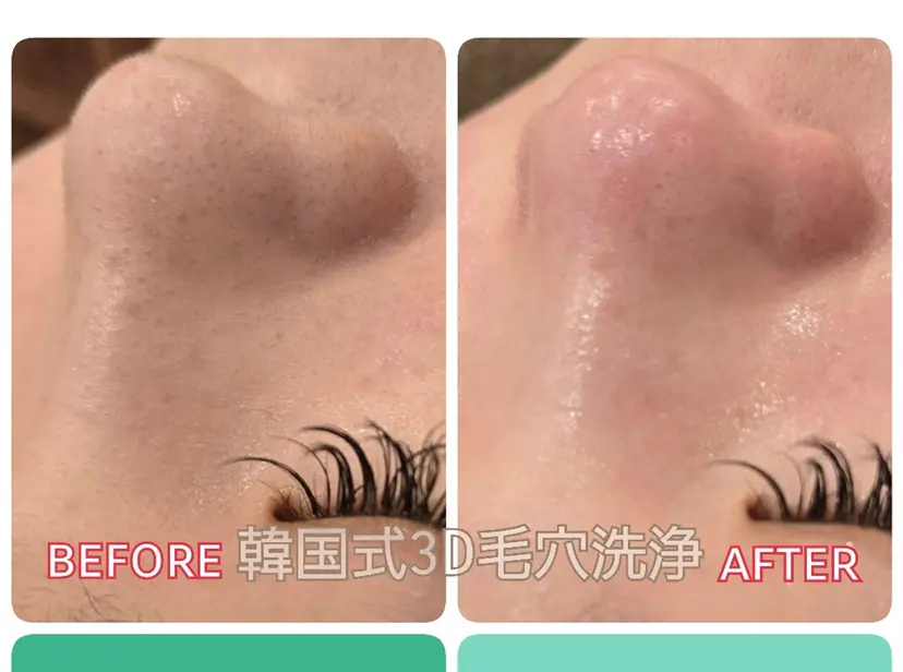 SIKI Beautyの掲載