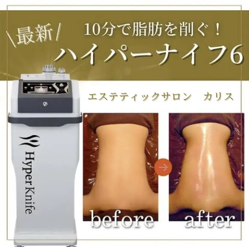 ハイパーナイフ痩身 Misakiの掲載