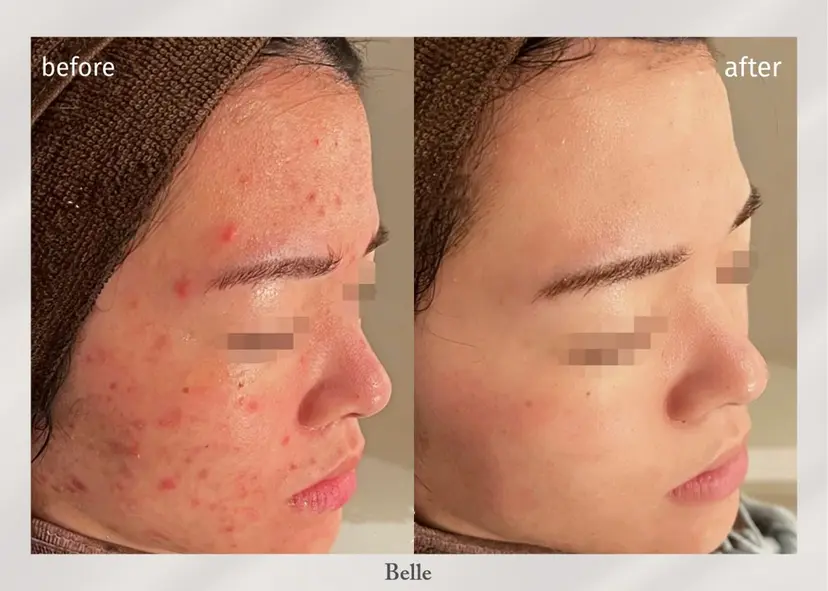 店長 RUNAの掲載