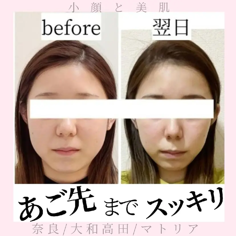 小顔 美肌専門 Matoriaの掲載