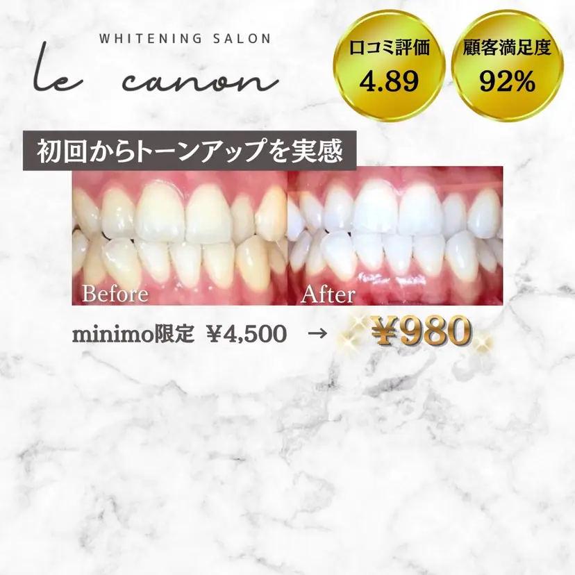 ホワイトニングサロン le  canonの掲載
