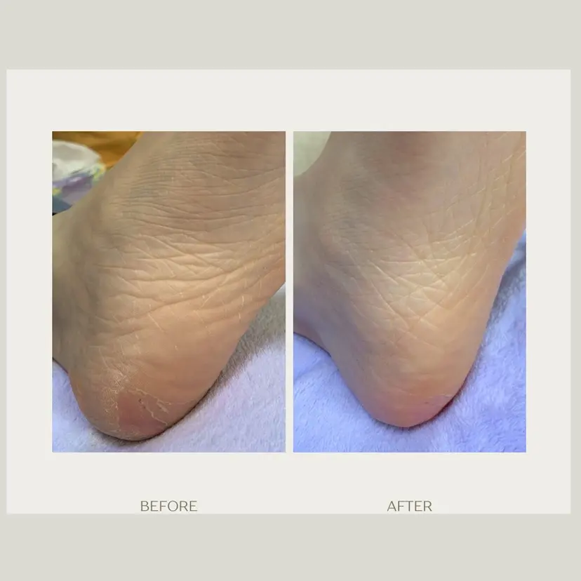 足トラブル専門 ニコルル金沢の掲載