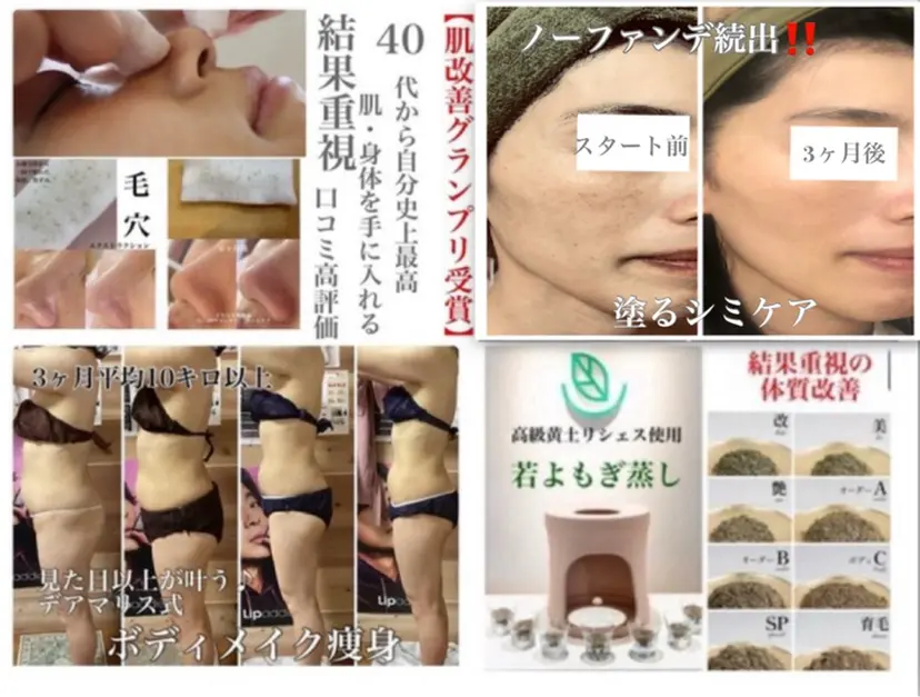 シミ改善・韓国肌管理 ボディメイク痩身の掲載