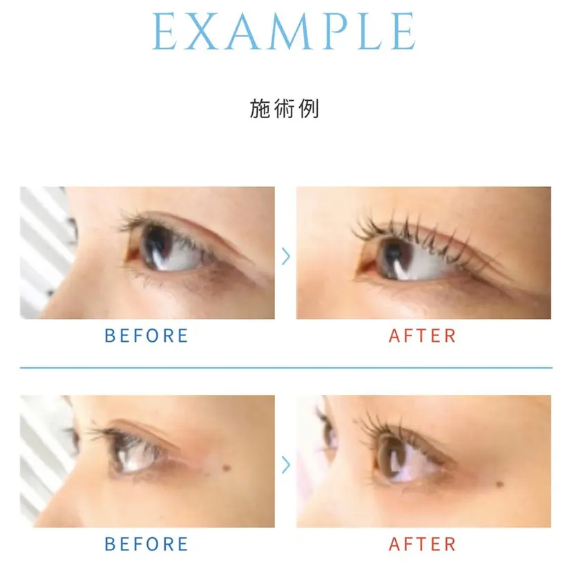 TOYOOKA ERUMOの掲載