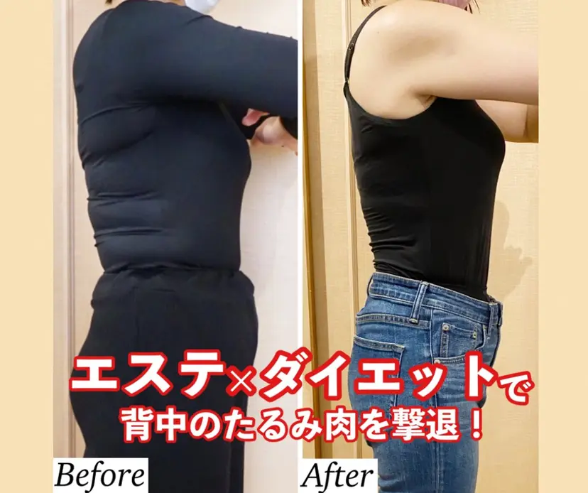 大分ダイエット専門 エステトレントの掲載