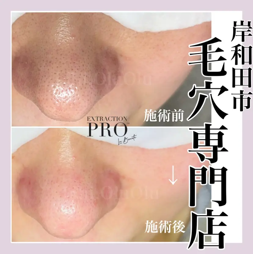 毛穴汚れ改善専門店/ 岸和田/リヒオルオルの掲載